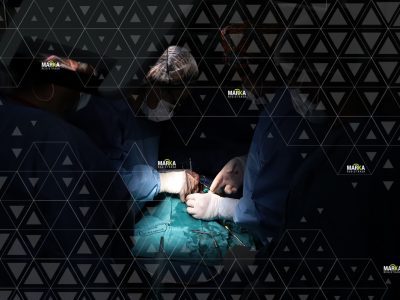La Paz: Llevan acabo la cirugía a corazón abierto en el paciente N° 300